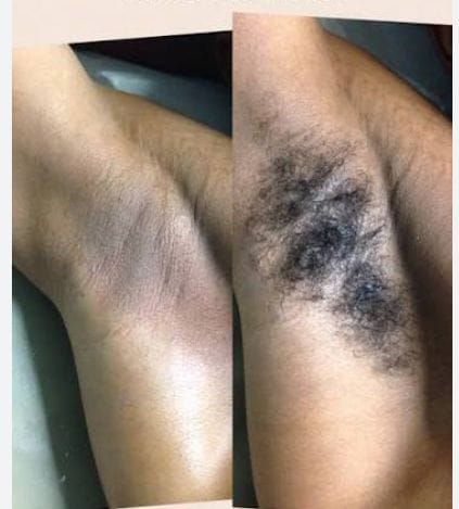 Smooth skin after waxing